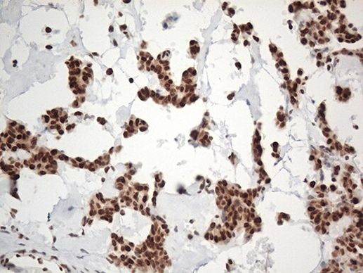 EWSR1 Antibody in Immunohistochemistry (Paraffin) (IHC (P))