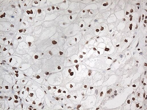 EWSR1 Antibody in Immunohistochemistry (Paraffin) (IHC (P))