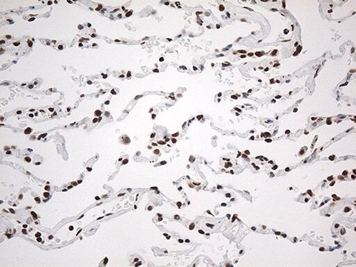 EWSR1 Antibody in Immunohistochemistry (Paraffin) (IHC (P))