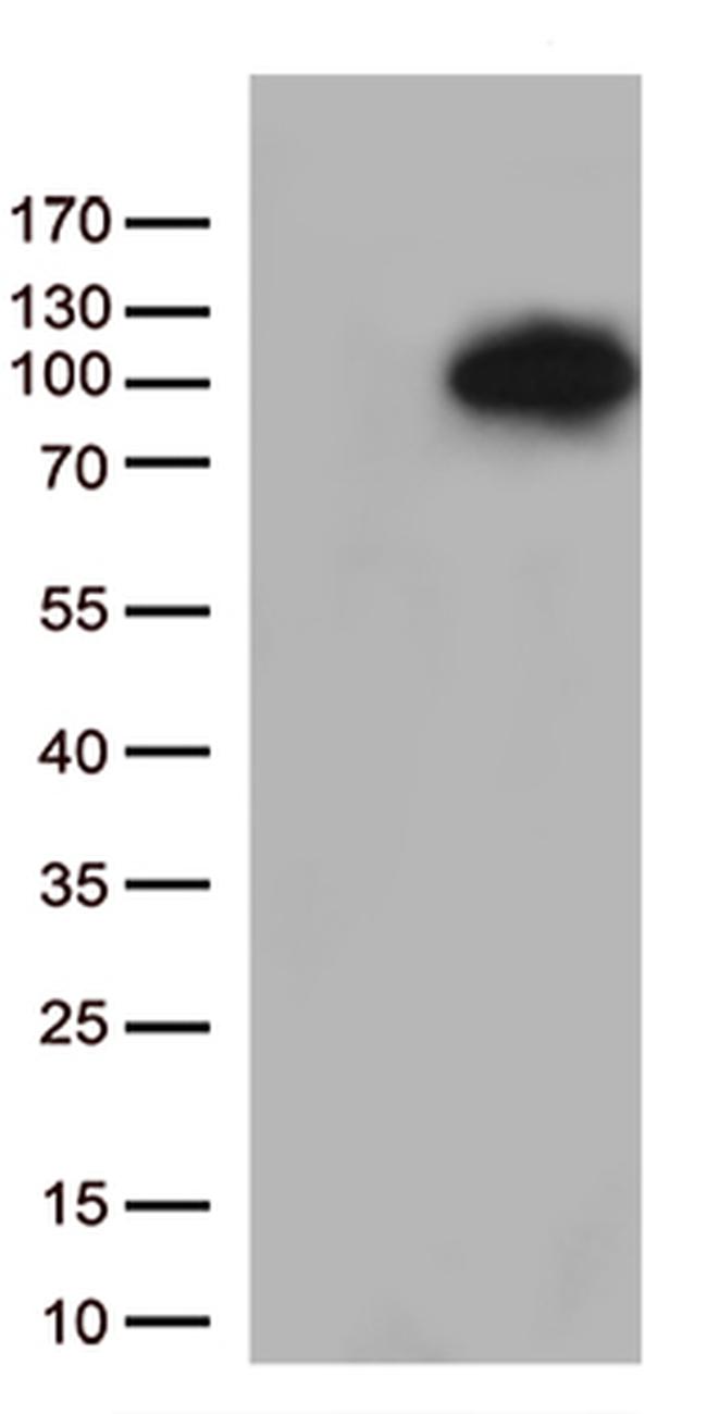 MEPCE Antibody in Western Blot (WB)