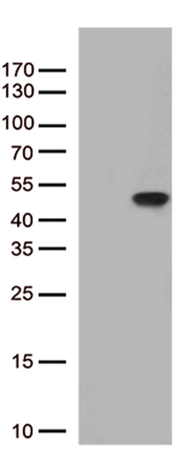 PTER Antibody in Western Blot (WB)