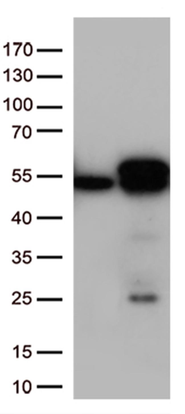 Calreticulin (CALR) Antibody in Western Blot (WB)