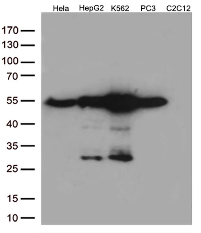 Calreticulin (CALR) Antibody in Western Blot (WB)