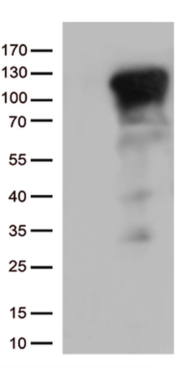 NFKB1 Antibody in Western Blot (WB)