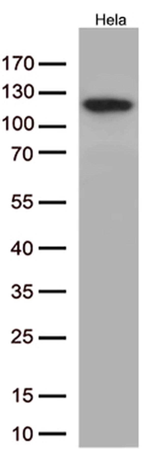 NFKB1 Antibody in Western Blot (WB)