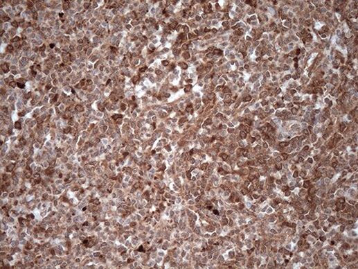 PKR (EIF2AK2) Antibody in Immunohistochemistry (Paraffin) (IHC (P))