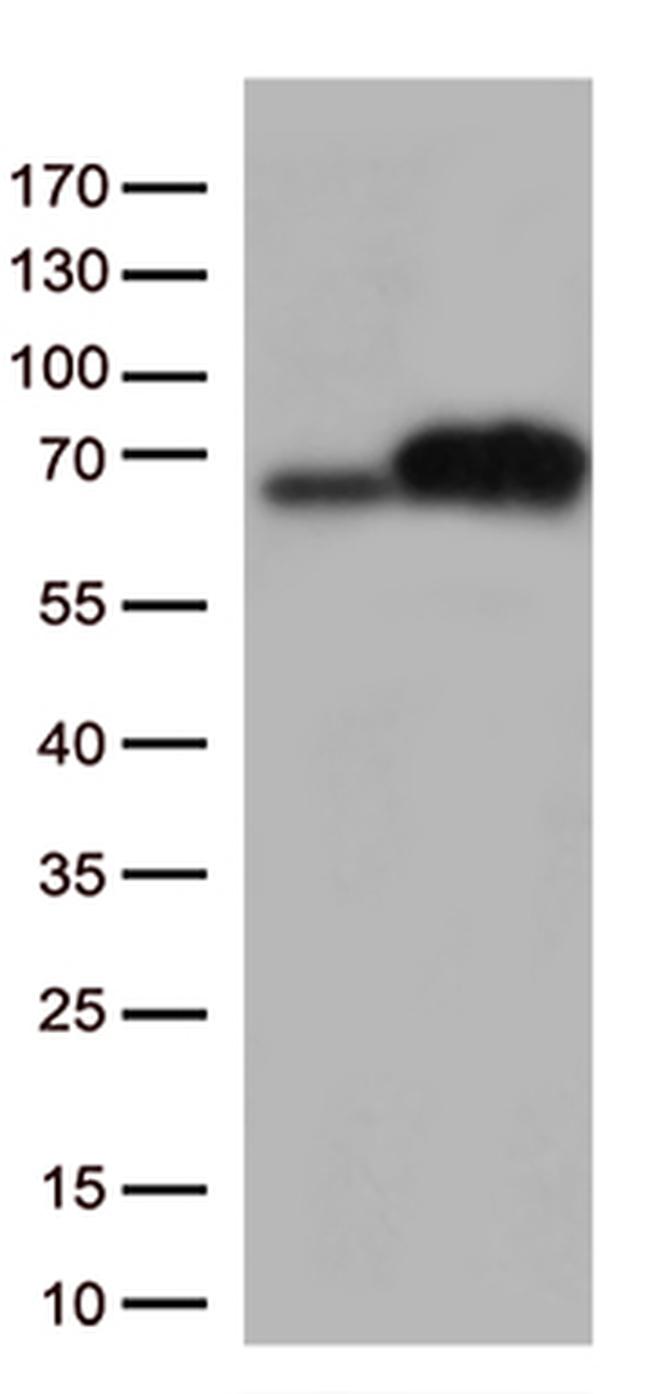 PKR (EIF2AK2) Antibody in Western Blot (WB)