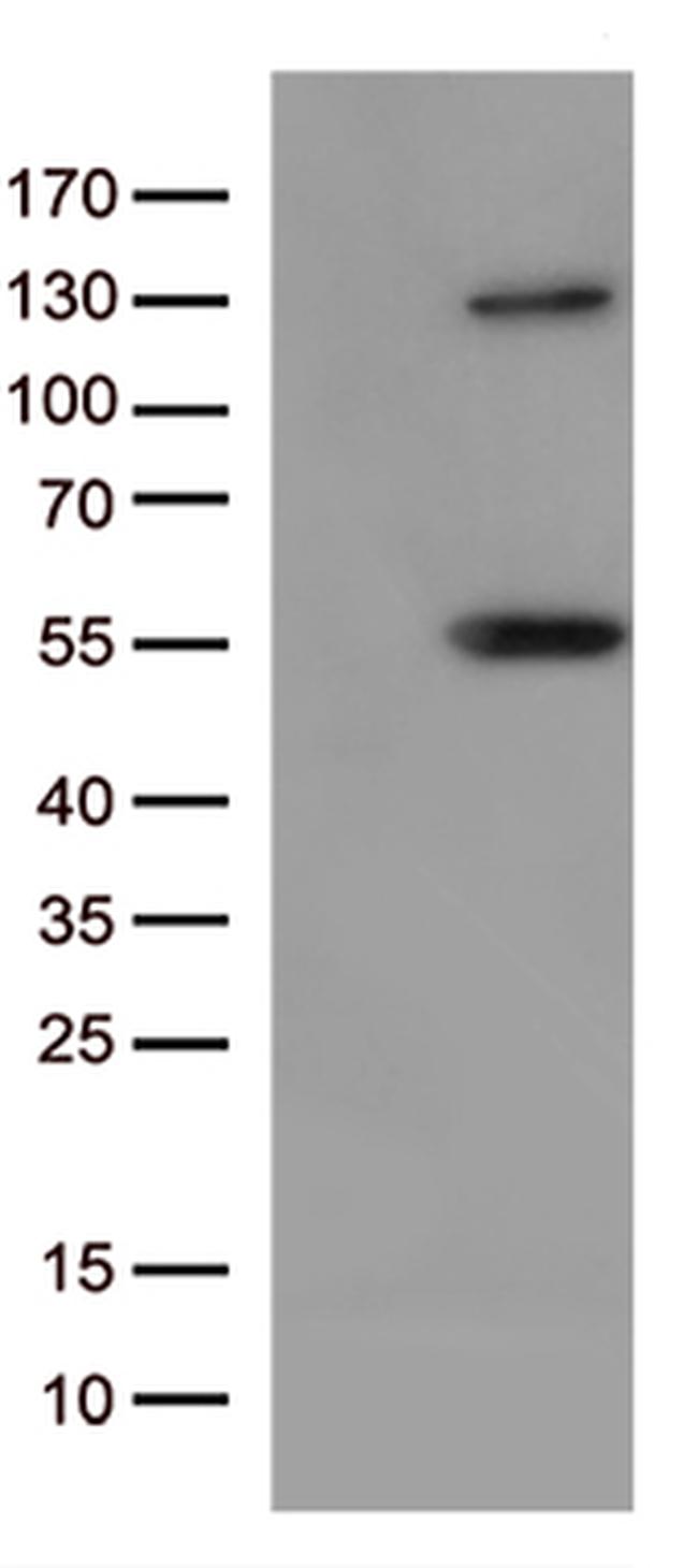 JNK3 (MAPK10) Antibody in Western Blot (WB)