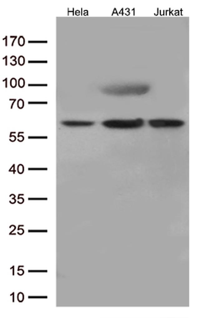 JNK3 (MAPK10) Antibody in Western Blot (WB)