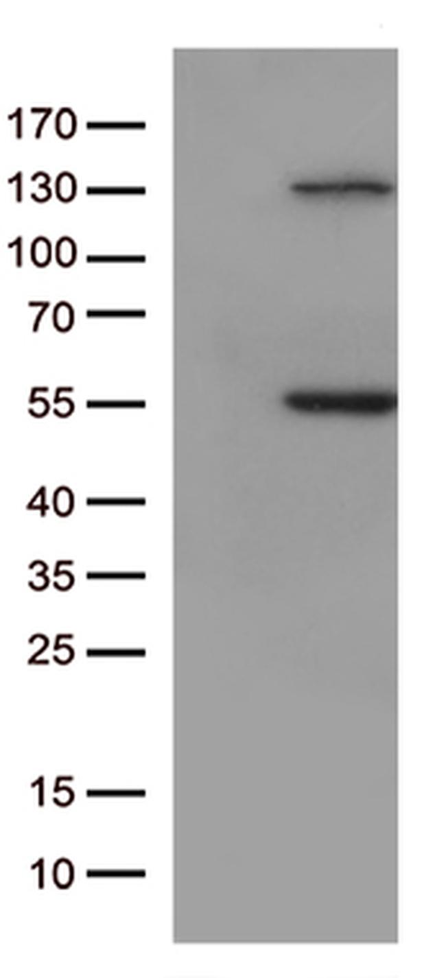 JNK3 (MAPK10) Antibody in Western Blot (WB)