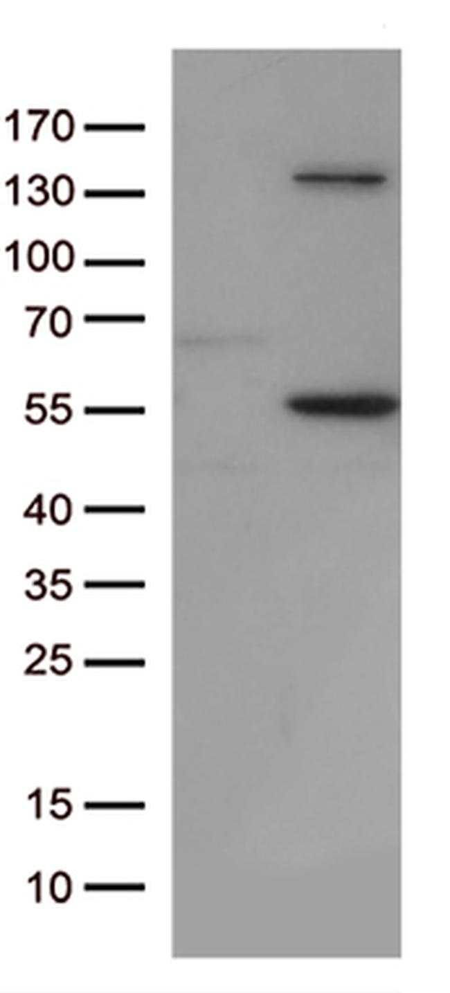 JNK3 (MAPK10) Antibody in Western Blot (WB)