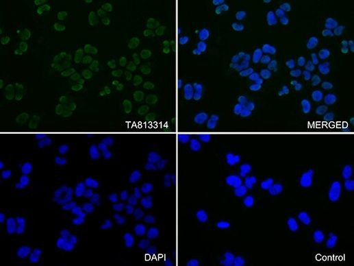 KAP1 (TRIM28) Antibody in Immunocytochemistry (ICC/IF)