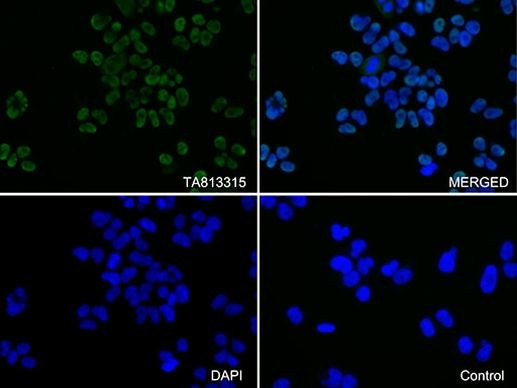 KAP1 (TRIM28) Antibody in Immunocytochemistry (ICC/IF)