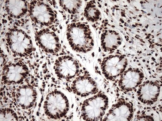 KAP1 (TRIM28) Antibody in Immunohistochemistry (Paraffin) (IHC (P))