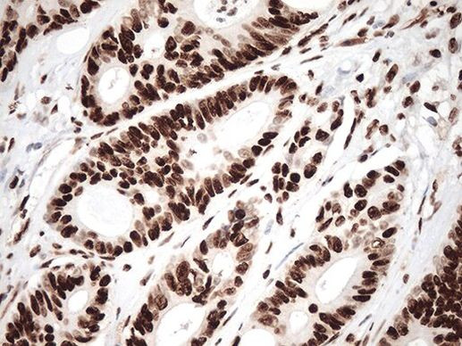 KAP1 (TRIM28) Antibody in Immunohistochemistry (Paraffin) (IHC (P))