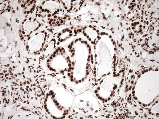 KAP1 (TRIM28) Antibody in Immunohistochemistry (Paraffin) (IHC (P))