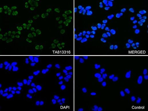 KAP1 (TRIM28) Antibody in Immunocytochemistry (ICC/IF)