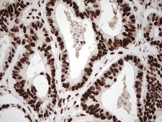 KAP1 (TRIM28) Antibody in Immunohistochemistry (Paraffin) (IHC (P))