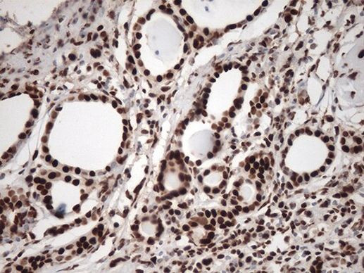 KAP1 (TRIM28) Antibody in Immunohistochemistry (Paraffin) (IHC (P))