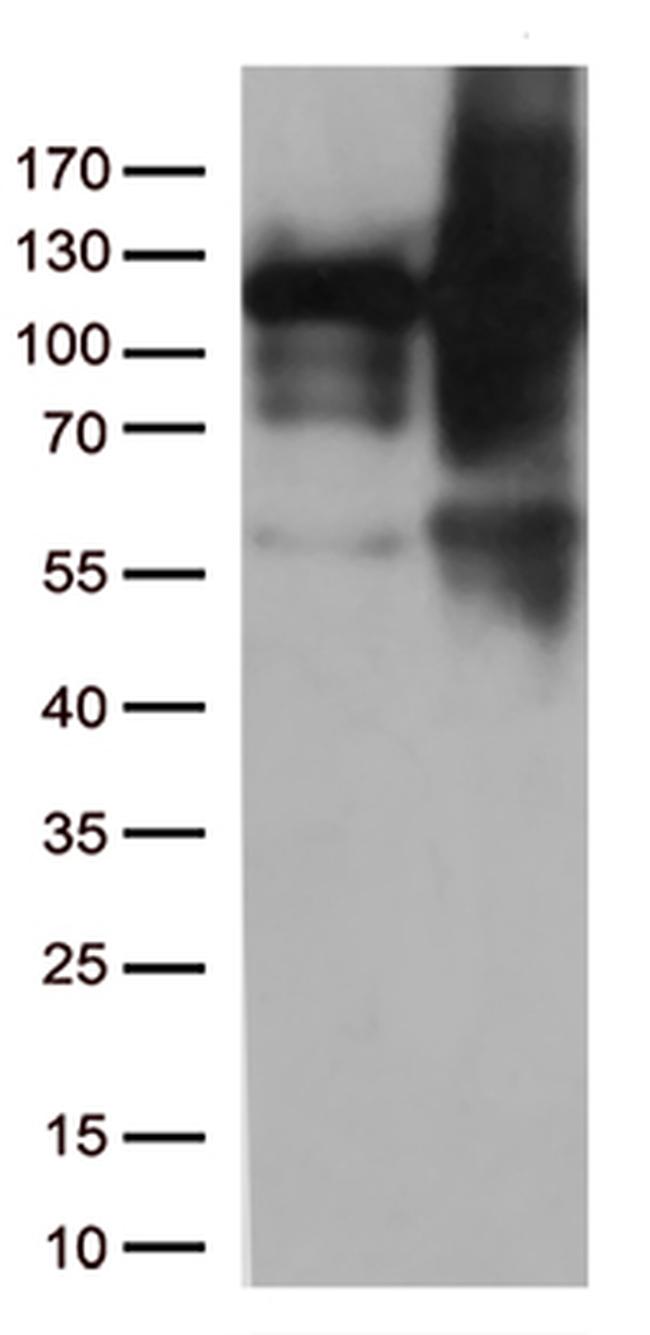 KAP1 (TRIM28) Antibody in Western Blot (WB)