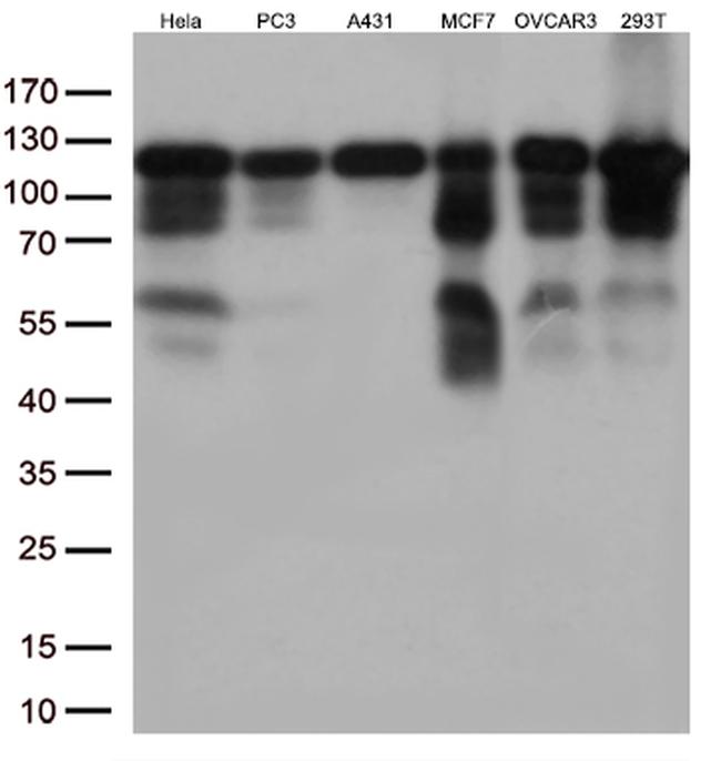 KAP1 (TRIM28) Antibody in Western Blot (WB)