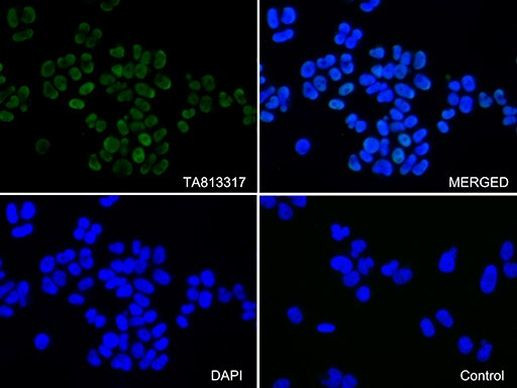 KAP1 (TRIM28) Antibody in Immunocytochemistry (ICC/IF)