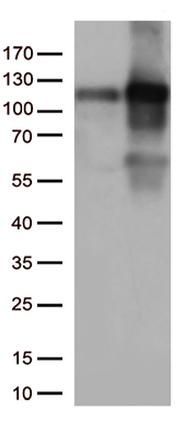 KAP1 (TRIM28) Antibody in Western Blot (WB)