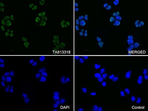 KAP1 (TRIM28) Antibody in Immunocytochemistry (ICC/IF)