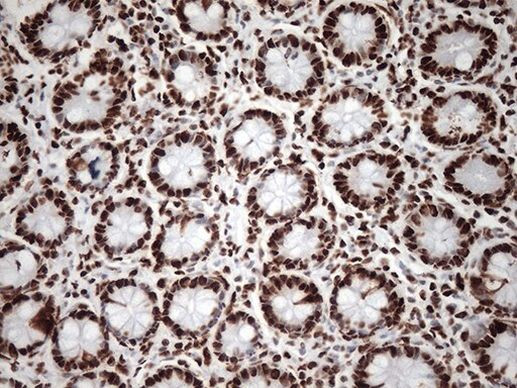 KAP1 (TRIM28) Antibody in Immunohistochemistry (Paraffin) (IHC (P))