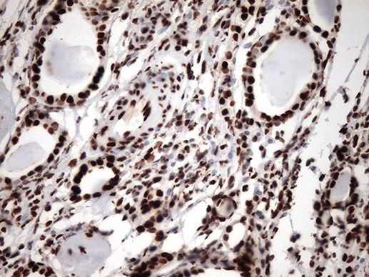 KAP1 (TRIM28) Antibody in Immunohistochemistry (Paraffin) (IHC (P))