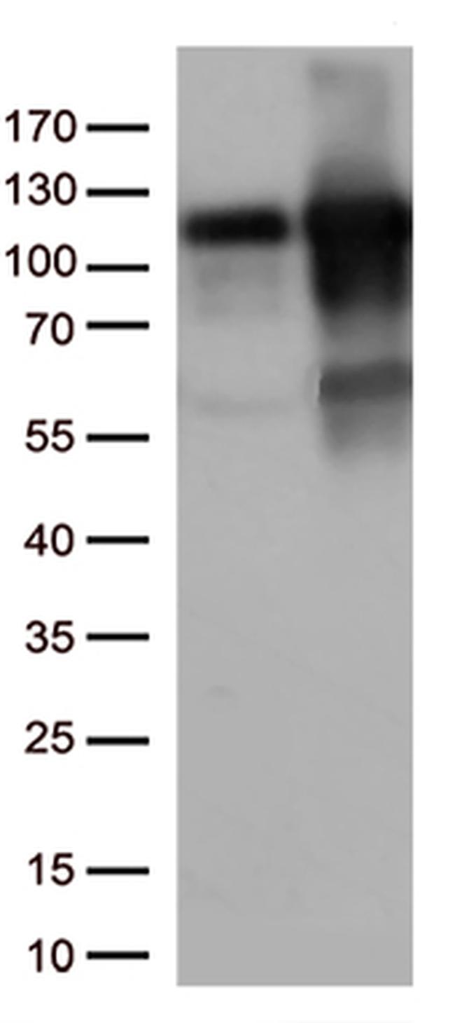 KAP1 (TRIM28) Antibody in Western Blot (WB)