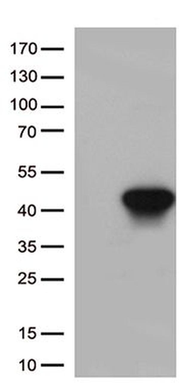 HLAA (HLA-A) Antibody in Western Blot (WB)