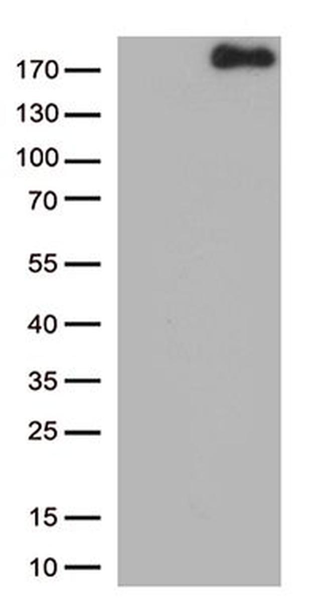 NPHS1 Antibody in Western Blot (WB)