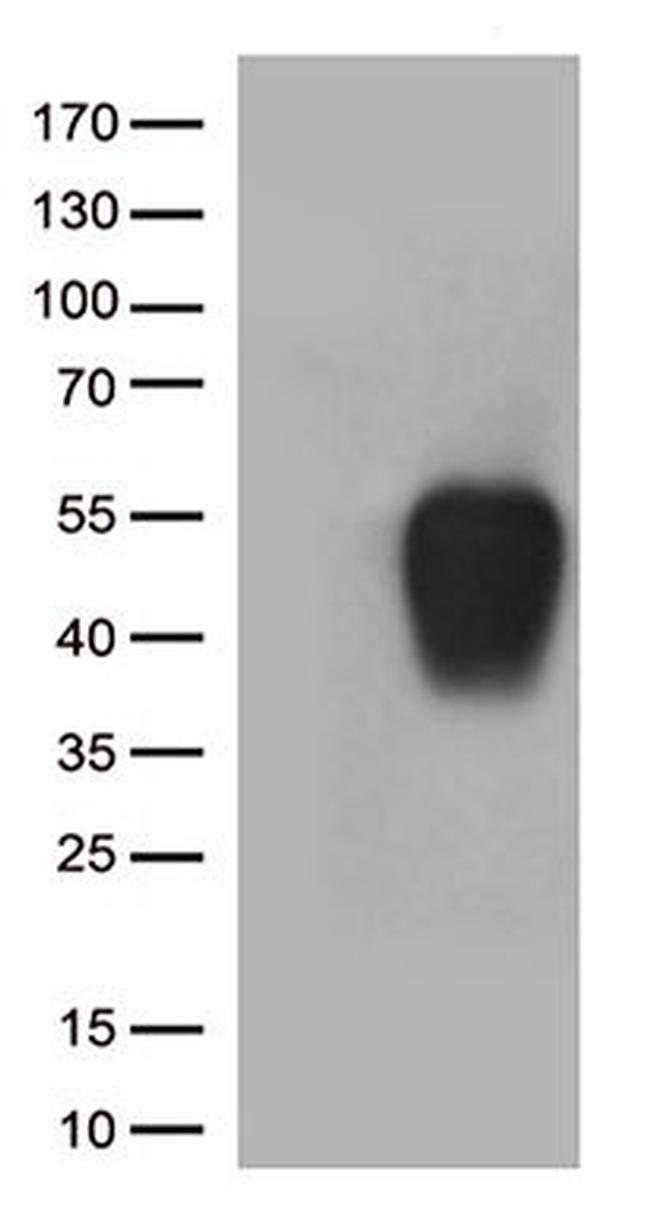 SLAMF7 Antibody in Western Blot (WB)