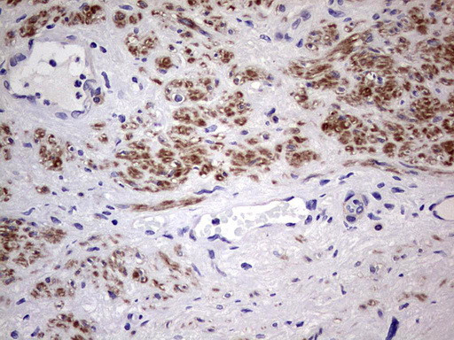 CFLAR Antibody in Immunohistochemistry (Paraffin) (IHC (P))