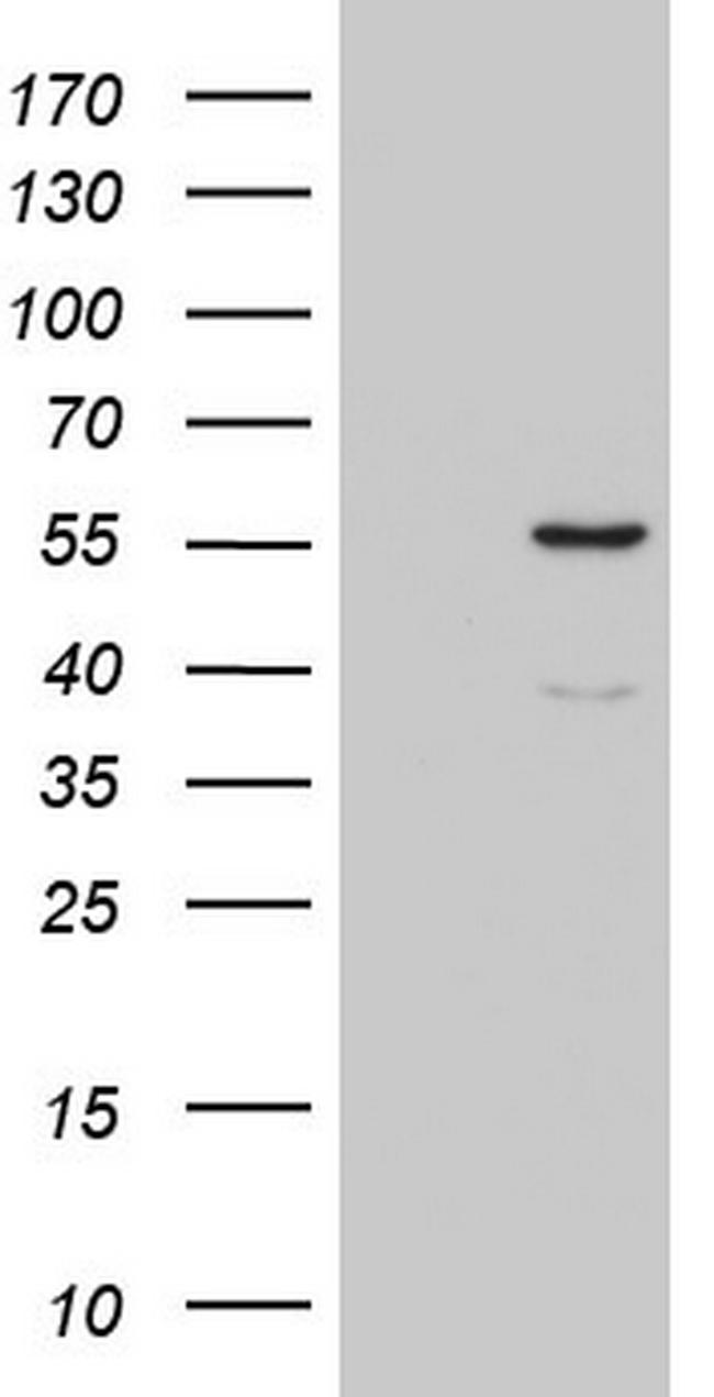 CFLAR Antibody in Western Blot (WB)