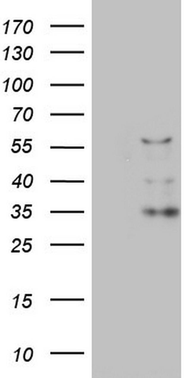 CFLAR Antibody in Western Blot (WB)