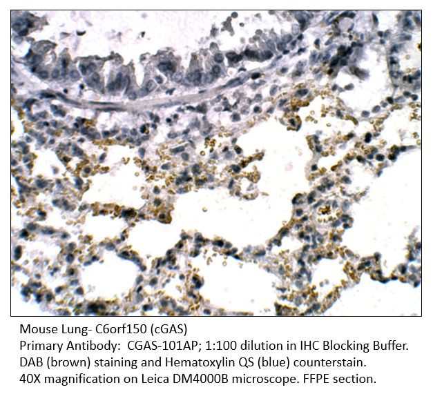 C6orf150 Antibody in Immunohistochemistry (IHC)