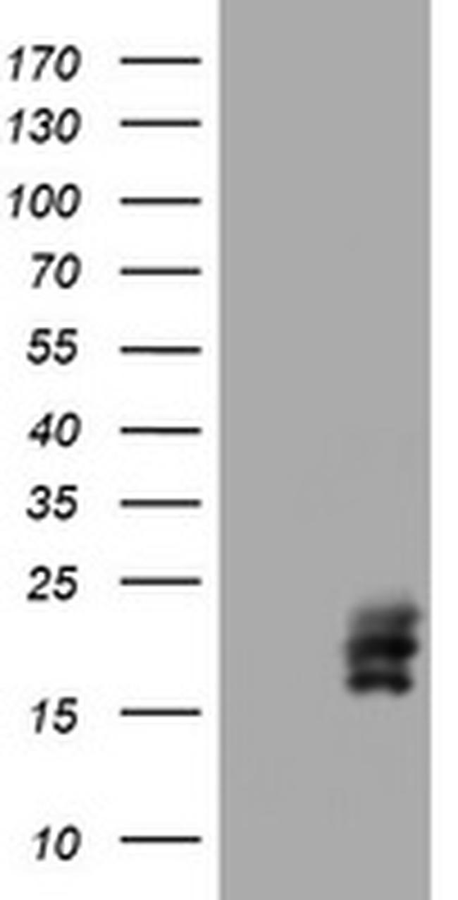 CGB Antibody in Western Blot (WB)