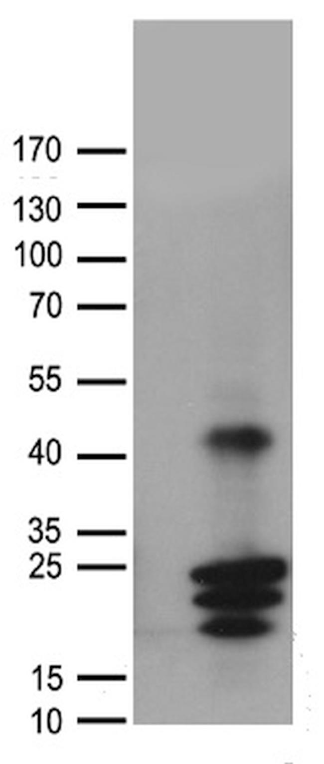 CGB7 Antibody in Western Blot (WB)