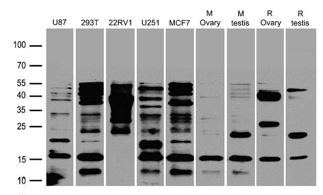 CGB7 Antibody in Western Blot (WB)