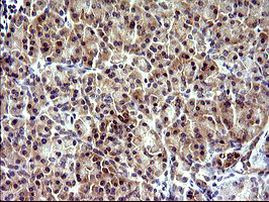 CHAC1 Antibody in Immunohistochemistry (Paraffin) (IHC (P))