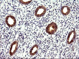 CHAC1 Antibody in Immunohistochemistry (Paraffin) (IHC (P))