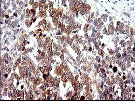 CHAC1 Antibody in Immunohistochemistry (Paraffin) (IHC (P))