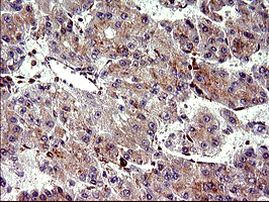 CHAC1 Antibody in Immunohistochemistry (Paraffin) (IHC (P))