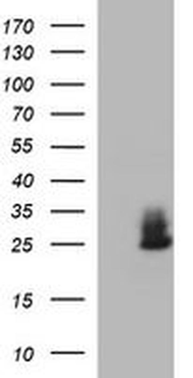 CHAC1 Antibody in Western Blot (WB)