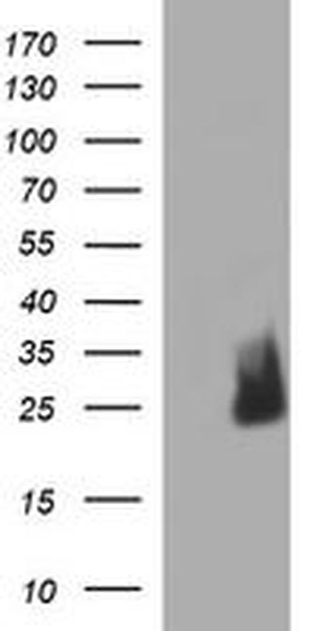 CHAC1 Antibody in Western Blot (WB)