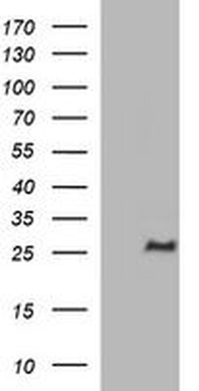 CHAC1 Antibody in Western Blot (WB)