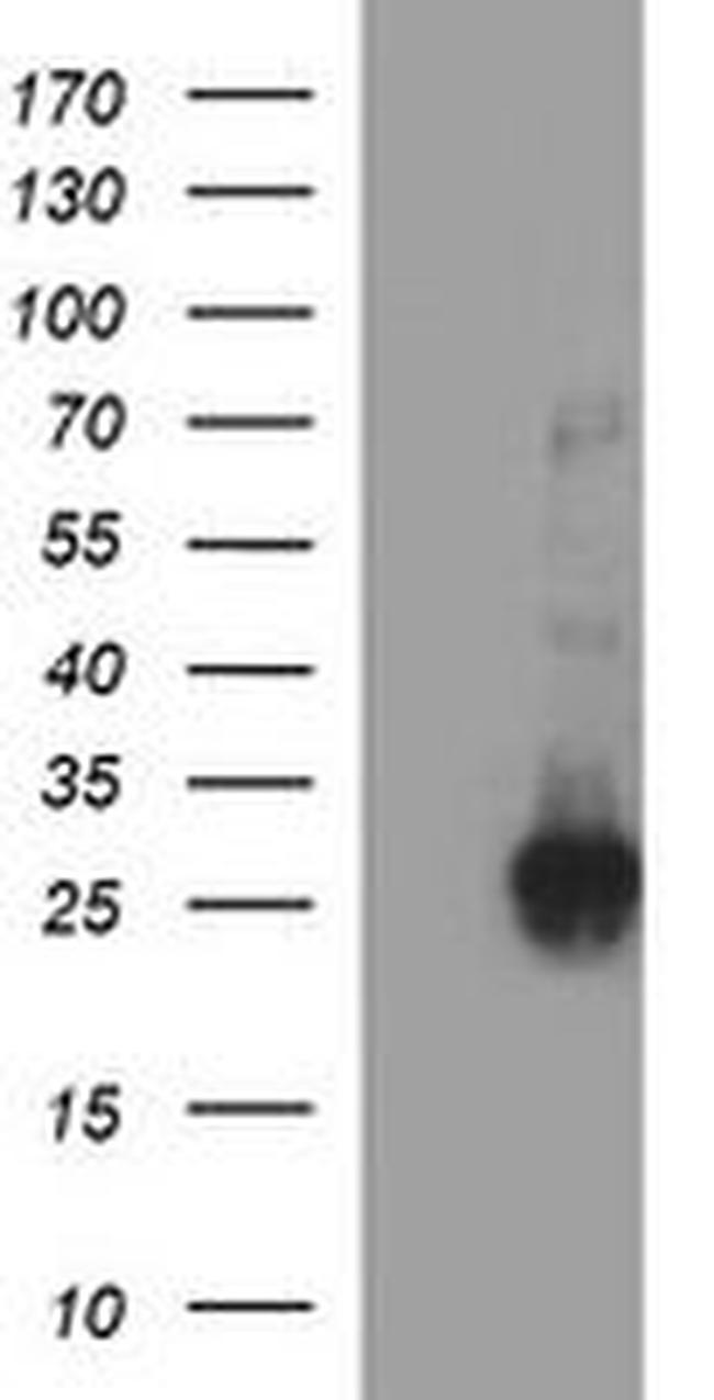 CHAC1 Antibody in Western Blot (WB)