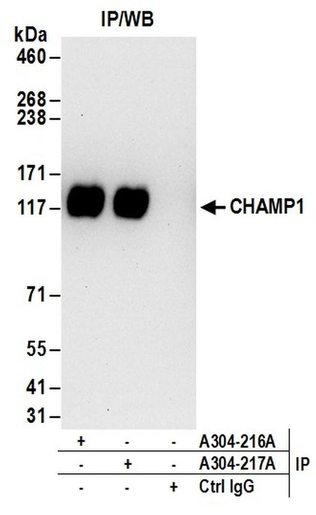 CHAMP1 Antibody in Western Blot (WB)